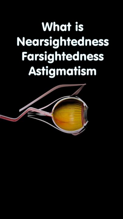 nearsightedness-farsightedness-astigmatism-eyesight-academy