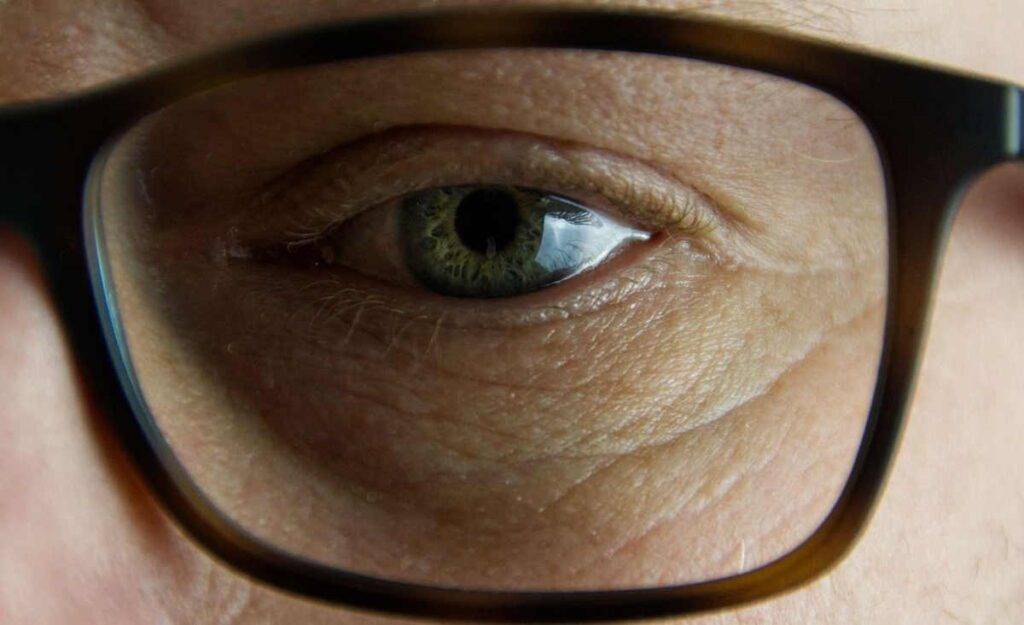 How to heal Macular Degeneration Natural Ways to Improve Vision